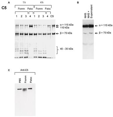 Pathogenic Leptospira Secreted Proteases Target the Membrane Attack Complex: A Potential Role for Thermolysin in Complement Inhibition